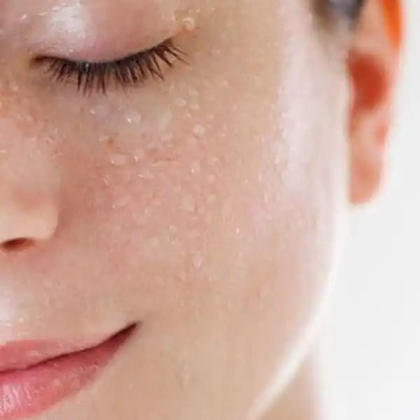 Close-up view of freckled skin and eyelashes.