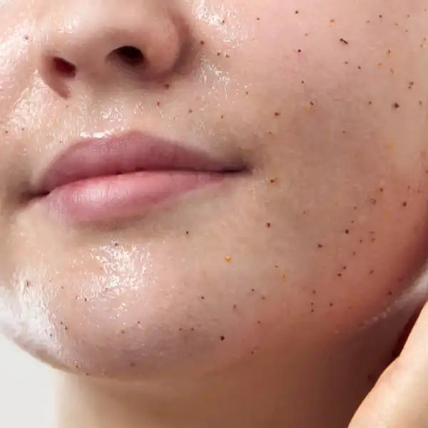 Close-up view of lips and skin with freckles.